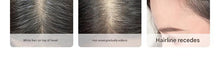 Load image into Gallery viewer, Silk Base Human Hair Topper for Women - Daily Wear Undetectable Hairpiece, Double Wefted Design for Thinning Hair &amp; Gray Coverage, Breathable High Crown Volume &amp; Natural Look-غطاء رأس من شعر الإنسان بقاعدة حريرية للنساء
