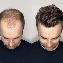 Load image into Gallery viewer, Estelle Australian Hair Patch for Men, 100% Human Hair, Natural Looking Thin Front Lace Hair Brown
